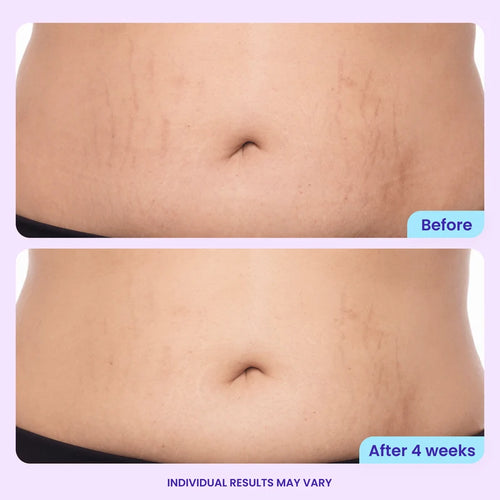 GOLUNE Moonlift Belly Cream